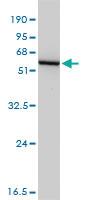 Anti-GSS Mouse Monoclonal Antibody [clone: 4B6]