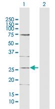 Anti-DDIT4L Rabbit Polyclonal Antibody