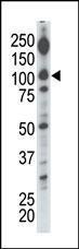 Anti-DGKI Rabbit Polyclonal Antibody (AP (Alkaline Phosphatase))