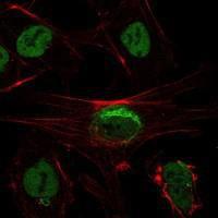 Anti-SIRT1 Mouse Monoclonal Antibody [clone: 1F3]