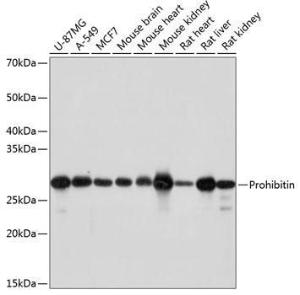 Western blot analysis of extracts of various cell lines, using Anti-Prohibitin Antibody [ARC0007] (A305437) at 1:1000 dilution