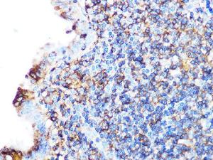 Immunohistochemistry analysis of paraffin-embedded human appendix tissue using Anti-Arp3 Antibody [ARC1067] (A306350) at a dilution of 1:100 (40x lens). Perform microwave antigen retrieval with 10 mM PBS buffer pH 7.2 before commencing with IHC staining protocol.