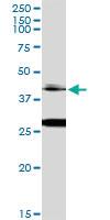 Anti-OTX1 Rabbit Polyclonal Antibody