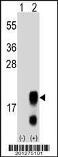 Anti-FSHB, FSH Mouse Monoclonal Antibody (APC (Allophycocyanin)) [clone: 365CT24.1.1]