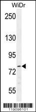 Anti-p21WAF1 Rabbit Polyclonal Antibody (AP (Alkaline Phosphatase))