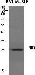 Western blot analysis of various cells using Anti-BID Antibody