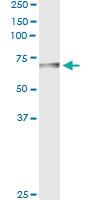 Anti-BTD Antibody Pair