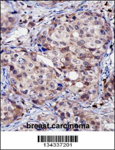 Anti-RNF144A Rabbit Polyclonal Antibody