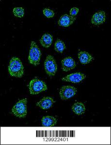 Anti-PABPN1L Rabbit Polyclonal Antibody (Biotin)