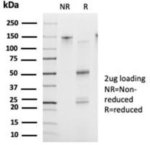 SDS-PAGE analysis of Anti-FOXB2 Antibody [PCRP-FOXB2-2B2] under non-reduced and reduced conditions; showing intact IgG and intact heavy and light chains, respectively. SDS-PAGE analysis confirms the integrity and purity of the antibody.