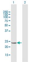 Anti-GSTA1 Mouse Polyclonal Antibody