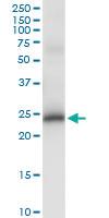 Anti-DDIT4L Rabbit Polyclonal Antibody