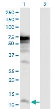 Anti-POLR3K Rabbit Polyclonal Antibody