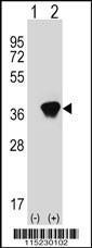 Anti-AKR1A1 Rabbit Polyclonal Antibody