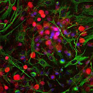 Immunofluorescent analysis of cortical neuron-glial cell culture from E20 rat stained with Anti-UCHL1 Antibody (1:500 / red) and Anti-Vimentin Antibody (A85423 / 1:2,000 / green). The blue is DAPI staining of nuclear DNA.