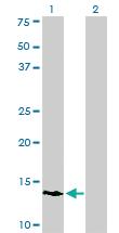 Anti-POLR3K Mouse Monoclonal Antibody [clone: 3F5]