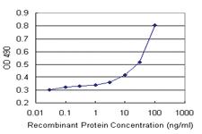 Anti-WDR79 Polyclonal Antibody Pair