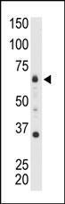 Anti-MTMR8 Rabbit Polyclonal Antibody (PE (Phycoerythrin))