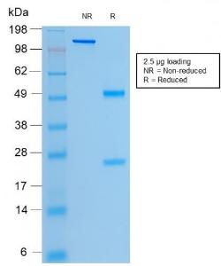 SDS-PAGE analysis of Anti-CFTR Antibody [rCFTR/1342] under non-reduced and reduced conditions; showing intact IgG and intact heavy and light chains, respectively. SDS-PAGE analysis confirms the integrity and purity of the antibody.