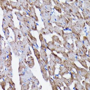 Immunohistochemistry analysis of paraffin-embedded rat heart using Anti-Prohibitin Antibody [ARC0007] (A305437) at a dilution of 1:100 (40x lens). Perform microwave antigen retrieval with 10 mM PBS buffer pH 7.2 before commencing with IHC staining protocol