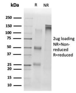 SDS-PAGE analysis of Anti-SIRT1 Antibody [PCRP-SIRT1-1E11] under non-reduced and reduced conditions; showing intact IgG and intact heavy and light chains, respectively. SDS-PAGE analysis confirms the integrity and purity of the antibody