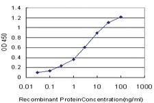 Anti-OTX1 Mouse Monoclonal Antibody [clone: 4E5]