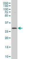 Anti-ICK Mouse Polyclonal Antibody