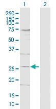 Anti-DDIT4L Rabbit Polyclonal Antibody