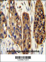 Anti-KIAA1324L Rabbit Polyclonal Antibody (HRP (Horseradish Peroxidase))