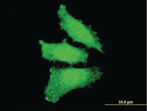 Anti-OTX1 Mouse Monoclonal Antibody [clone: 3D12]