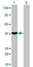 Anti-AKR1C4 Mouse Monoclonal Antibody [clone: 2C11]