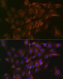 Immunofluorescence analysis of C6 cells using Anti-Arp3 Antibody [ARC1067] (A306350) at a dilution of 1:100 (40x lens). DAPI was used to stain the cell nuclei (blue).