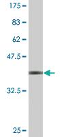 Anti-WRAP53 Mouse Monoclonal Antibody [clone: 1F12]