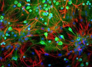 Rat mixed neuron/glial cultures stained with Anti-UCHL1 Antibody (green) and Anti-GFAP Antibody (A85419 / red). Blue is a DNA stain.