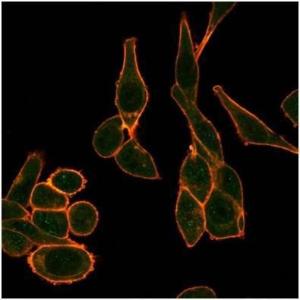 Immunofluorescent analysis of PFA-fixed HeLa cells stained with Anti-SIRT1 Antibody [PCRP-SIRT1-1E11] followed by Goat Anti-Mouse IgG (CF and #174; 488) (Blue). Isotype Control (Red)