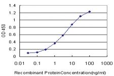 Anti-OTX1 Mouse Monoclonal Antibody [clone: 3D12]