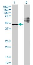 Anti-STARD3 Mouse Monoclonal Antibody [clone: 1D1]