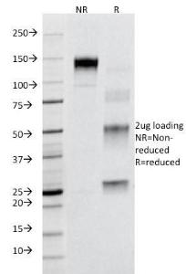 Anti-Fas Mouse Monoclonal Antibody [clone: B-R18]