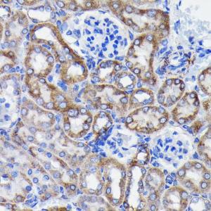 Immunohistochemistry analysis of paraffin-embedded mouse kidney using Anti-Prohibitin Antibody [ARC0007] (A305437) at a dilution of 1:100 (40x lens). Perform microwave antigen retrieval with 10 mM PBS buffer pH 7.2 before commencing with IHC staining protocol