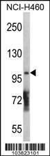 Anti-DGKQ Rabbit polyclonal antibody