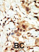 Anti-INSR Rabbit Polyclonal Antibody