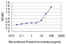 Anti-CXCL16 Mouse Monoclonal Antibody [clone: 2B12]