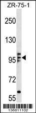 Anti-KIF20A Rabbit Polyclonal Antibody (AP (Alkaline Phosphatase))