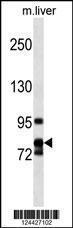 Anti-CCNF Rabbit Polyclonal Antibody (AP (Alkaline Phosphatase))