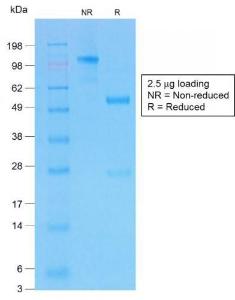 SDS-PAGE analysis of Anti-CFTR Antibody [CFTR/1775R] under non-reduced and reduced conditions; showing intact IgG and intact heavy and light chains, respectively. SDS-PAGE analysis confirms the integrity and purity of the antibody