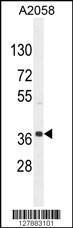 Anti-NKAPL Rabbit Polyclonal Antibody (AP (Alkaline Phosphatase))