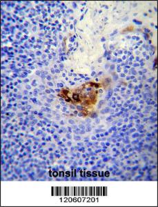 Anti-MCAM Rabbit Polyclonal Antibody (FITC (Fluorescein Isothiocyanate))