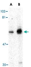 Anti-PTPN11 Rabbit Polyclonal Antibody