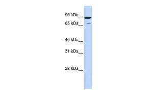 Anti-HIPK4 Rabbit Polyclonal Antibody