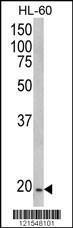 Anti-NADH Dehydrogenase Fe-S Protein 4 Rabbit Polyclonal Antibody (HRP (Horseradish Peroxidase))